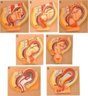 modele-developpement-foetus